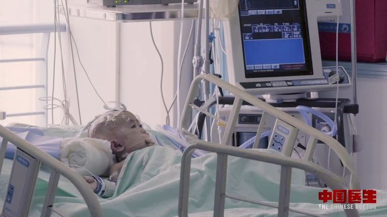国产纪录片《中国医生 The Chinese Doctor 2019》全9集 英语中字 1080P/MP4/5.32G 医疗纪录片插图3 国产纪录片《中国医生 The Chinese Doctor 2019》全9集 英语中字 1080P/MP4/5.32G 医疗纪录片插图3